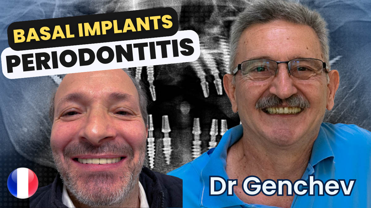 Basalimplantate bei Parodontitis